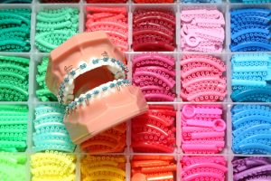 Best Braces Colors - 5 Most Popular Braces Colors